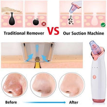 Load image into Gallery viewer, Pore-Cleansing-Vacuum-2